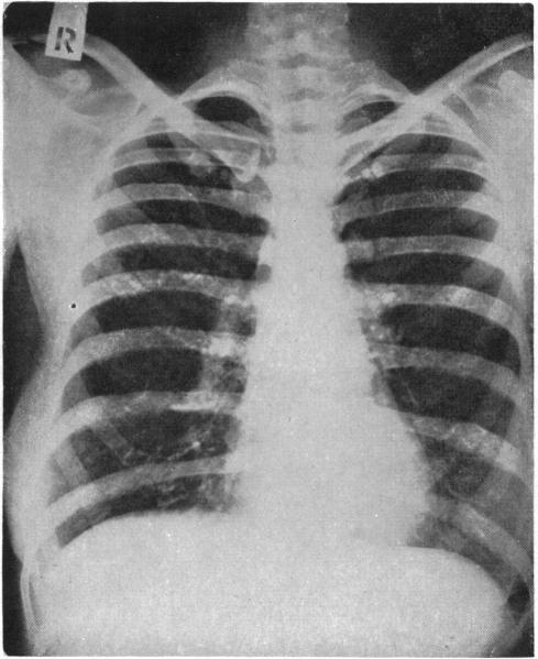 https://cdn.ncbi.nlm.nih.gov/pmc/blobs/dfb5/2039667/fd43ff78b4f5/brmedj03579-0011-d.jpg