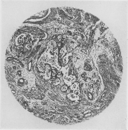 https://cdn.ncbi.nlm.nih.gov/pmc/blobs/dfb6/1617868/bedcb07db452/annsurg01458-0121-b.jpg