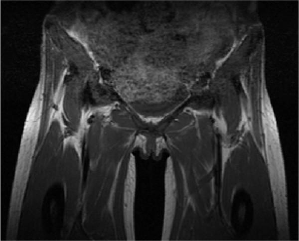 https://cdn.ncbi.nlm.nih.gov/pmc/blobs/dfbb/2904793/17d45b204ed4/1752-1947-4-198-2.jpg