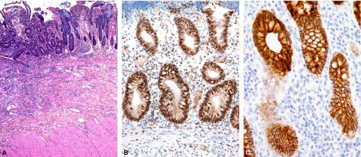 https://cdn.ncbi.nlm.nih.gov/pmc/blobs/dfbb/5020622/24033428833a/JCMM-20-1813-g003.jpg