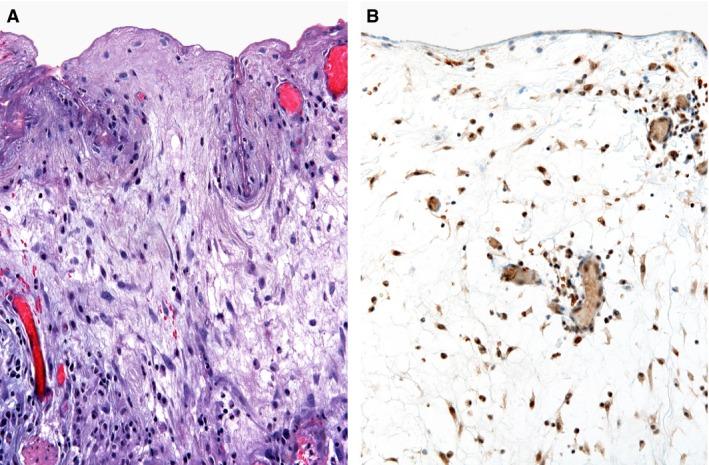 https://cdn.ncbi.nlm.nih.gov/pmc/blobs/dfbb/5020622/97ad952d440a/JCMM-20-1813-g005.jpg