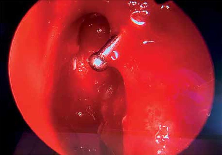 https://cdn.ncbi.nlm.nih.gov/pmc/blobs/dfbb/7687672/07196d3287b6/WIITM-15-39996-g010.jpg