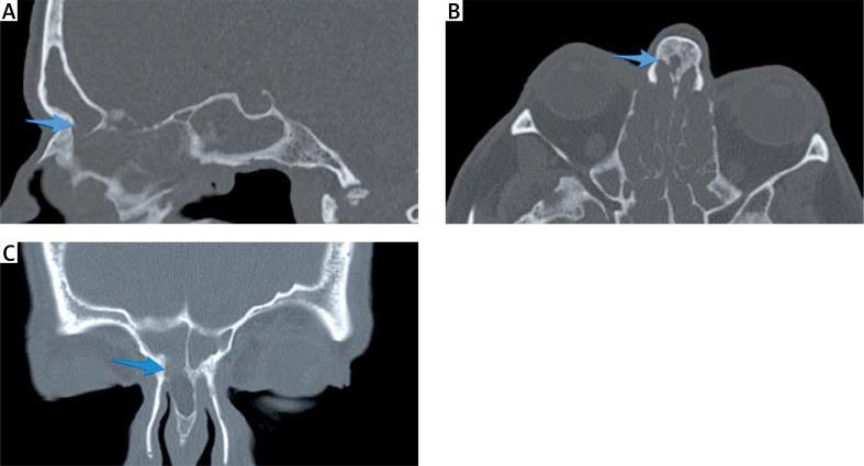 https://cdn.ncbi.nlm.nih.gov/pmc/blobs/dfbb/7687672/8a9cbc59f022/WIITM-15-39996-g005.jpg