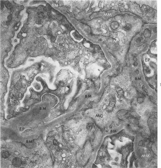 https://cdn.ncbi.nlm.nih.gov/pmc/blobs/dfc0/1949743/1d86400a343c/amjpathol00311-0044-a.jpg
