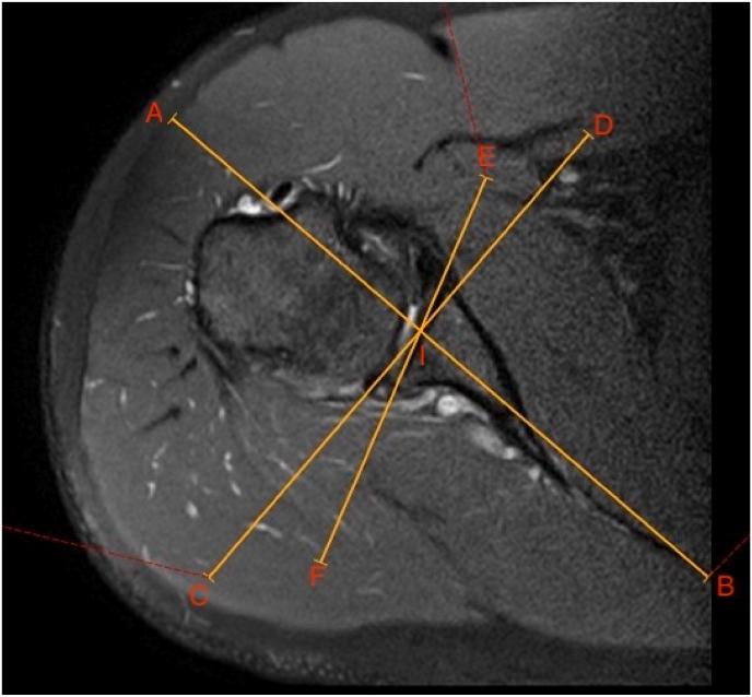https://cdn.ncbi.nlm.nih.gov/pmc/blobs/dfc1/10784136/5cd800759fac/gr1.jpg