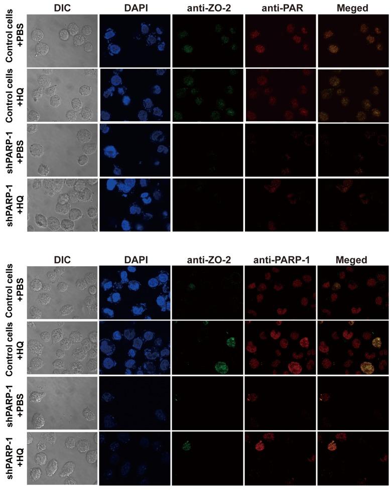 https://cdn.ncbi.nlm.nih.gov/pmc/blobs/dfc5/5779892/ea49c60d1e81/MMR-16-06-8076-g03.jpg