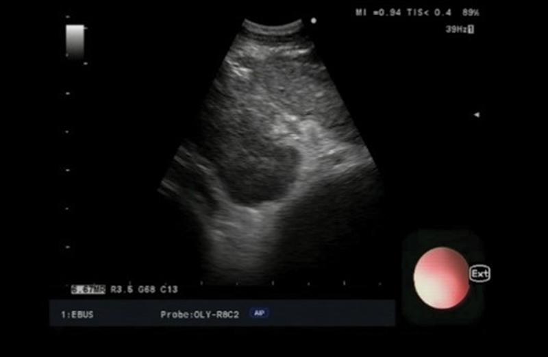 https://cdn.ncbi.nlm.nih.gov/pmc/blobs/dfc7/11164041/53d59ede2640/ZECR_A_2362995_F0005_OC.jpg