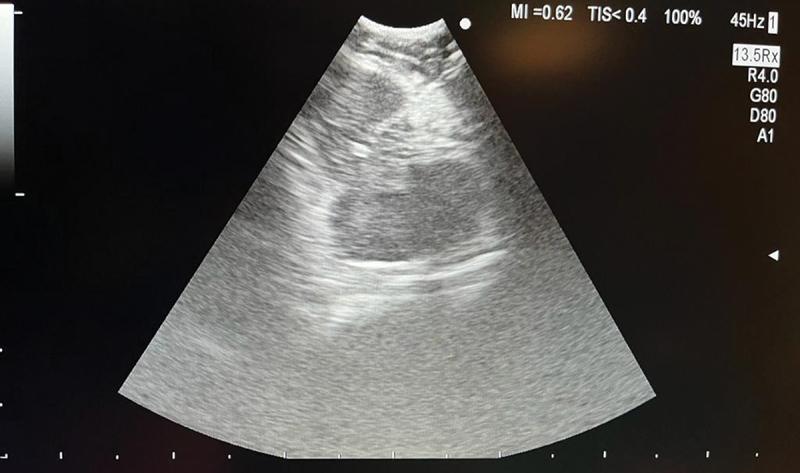 https://cdn.ncbi.nlm.nih.gov/pmc/blobs/dfc7/11164041/a18eabfa1c34/ZECR_A_2362995_F0006_OC.jpg