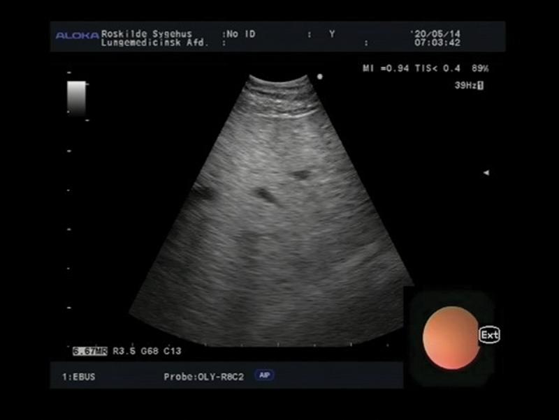 https://cdn.ncbi.nlm.nih.gov/pmc/blobs/dfc7/11164041/e5bb25758aae/ZECR_A_2362995_F0008_OC.jpg
