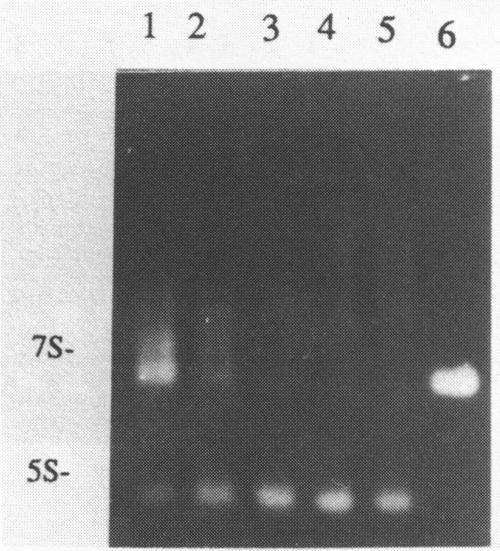https://cdn.ncbi.nlm.nih.gov/pmc/blobs/dfca/338572/69b2f22896df/nar00159-0301-a.jpg