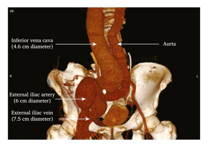 https://cdn.ncbi.nlm.nih.gov/pmc/blobs/dfcb/8501500/f889b3813cc1/gr1.jpg