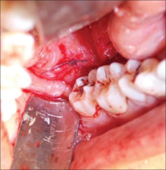 https://cdn.ncbi.nlm.nih.gov/pmc/blobs/dfcc/8237821/380cc2ce74e6/CCD-12-187-g003.jpg