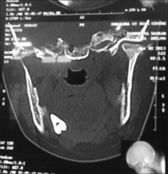 https://cdn.ncbi.nlm.nih.gov/pmc/blobs/dfcc/8237821/5d79b1071813/CCD-12-187-g001.jpg