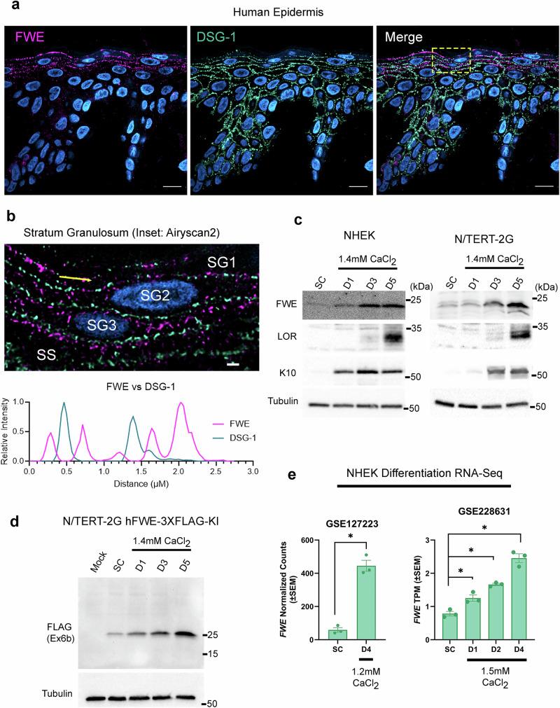 https://cdn.ncbi.nlm.nih.gov/pmc/blobs/dfcd/12297442/0fe7e7e78674/41467_2025_62105_Fig1_HTML.jpg
