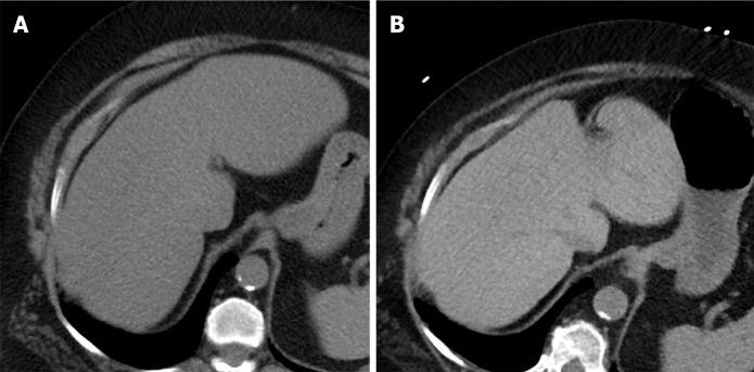 https://cdn.ncbi.nlm.nih.gov/pmc/blobs/dfcd/7772734/63a55f430e72/WJH-12-1258-g002.jpg
