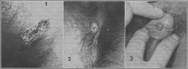 https://cdn.ncbi.nlm.nih.gov/pmc/blobs/dfd1/2035484/b42a5c683205/brmedj03178-0040-a.jpg