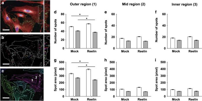 https://cdn.ncbi.nlm.nih.gov/pmc/blobs/dfd5/4994154/0f52d7a53ff0/npjschz201627-f5.jpg