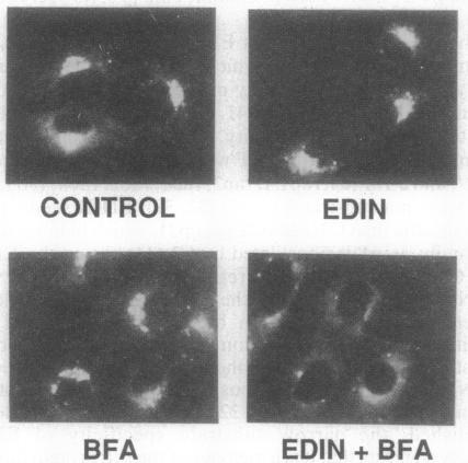 https://cdn.ncbi.nlm.nih.gov/pmc/blobs/dfdc/50032/00d6d0e9a94d/pnas01093-0057-a.jpg