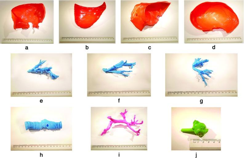 https://cdn.ncbi.nlm.nih.gov/pmc/blobs/dfe1/5702382/2d6c89b63b52/11548_2017_1527_Fig2_HTML.jpg
