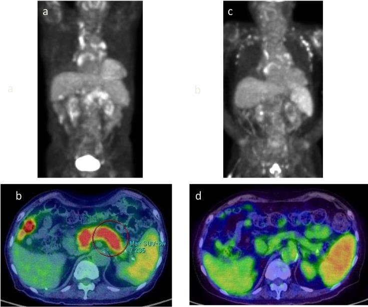 https://cdn.ncbi.nlm.nih.gov/pmc/blobs/dfeb/6545417/33ccf84454c0/jrm-14-110-g002.jpg