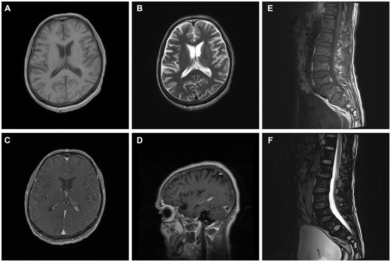 https://cdn.ncbi.nlm.nih.gov/pmc/blobs/dfed/11130402/2b9116dbc032/fpubh-12-1369703-g001.jpg