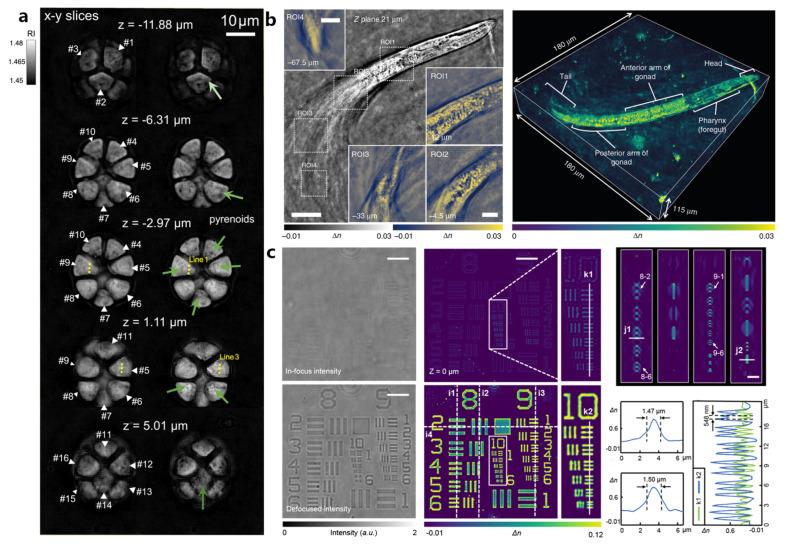 https://cdn.ncbi.nlm.nih.gov/pmc/blobs/dfee/10887115/85c40cfcff89/cells-13-00324-g008.jpg