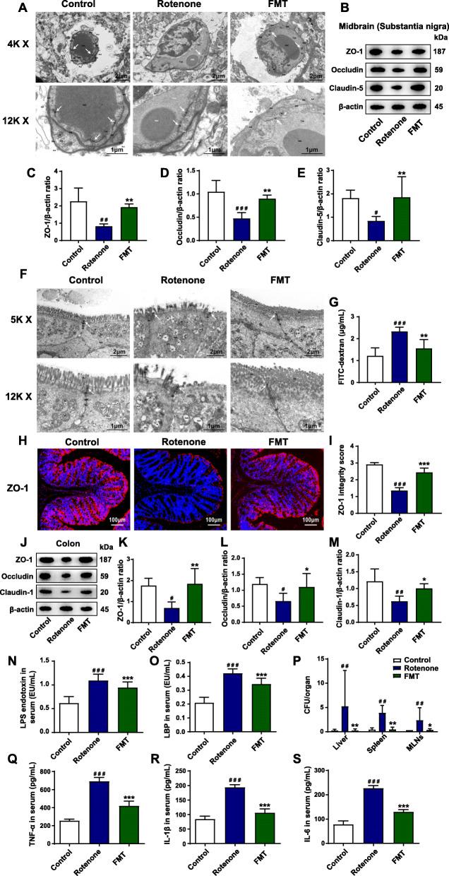 https://cdn.ncbi.nlm.nih.gov/pmc/blobs/dff6/8597301/27dcd32a9a4e/40168_2021_1107_Fig3_HTML.jpg