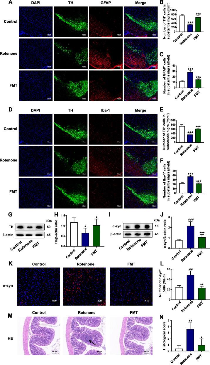 https://cdn.ncbi.nlm.nih.gov/pmc/blobs/dff6/8597301/80b611f54ed2/40168_2021_1107_Fig2_HTML.jpg