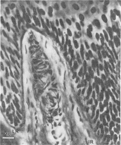 https://cdn.ncbi.nlm.nih.gov/pmc/blobs/dffc/490515/37c7a53a5437/jnnpsyc00071-0053-a.jpg