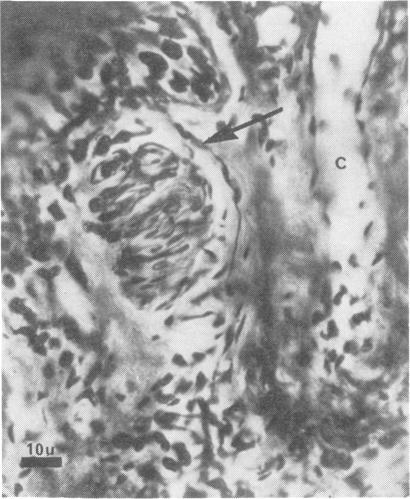 https://cdn.ncbi.nlm.nih.gov/pmc/blobs/dffc/490515/e6973c636ed5/jnnpsyc00071-0054-b.jpg
