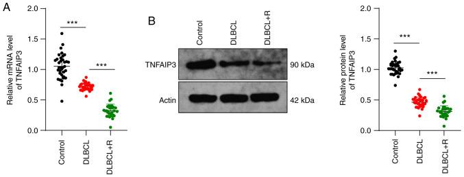 https://cdn.ncbi.nlm.nih.gov/pmc/blobs/e00c/8078569/8062117ea362/IJO-58-06-05211-g00.jpg