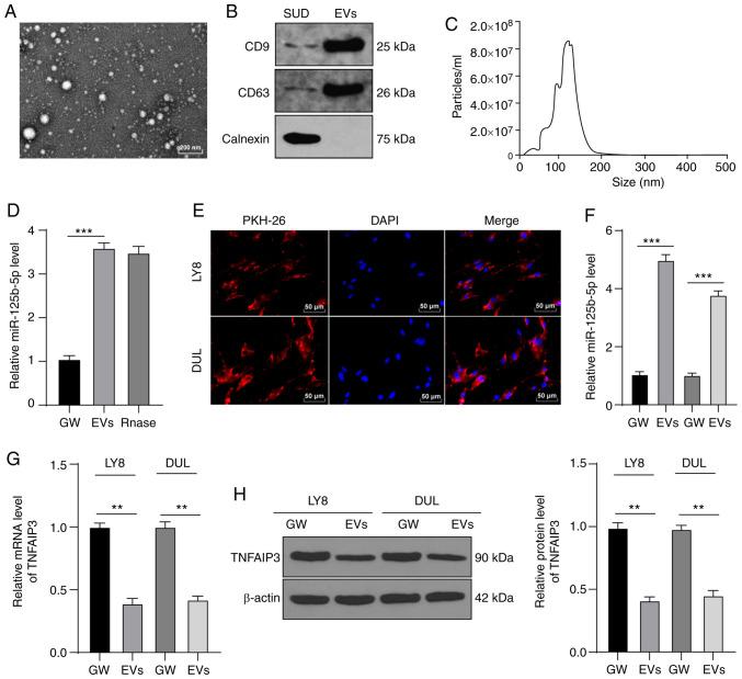 https://cdn.ncbi.nlm.nih.gov/pmc/blobs/e00c/8078569/924ec5b0b037/IJO-58-06-05211-g04.jpg