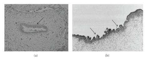 https://cdn.ncbi.nlm.nih.gov/pmc/blobs/e011/2926654/c82ee75883c8/MI2010-373878.002.jpg