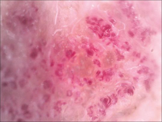 https://cdn.ncbi.nlm.nih.gov/pmc/blobs/e013/11152494/31a2d2492b1a/IDOJ-15-415-g009.jpg