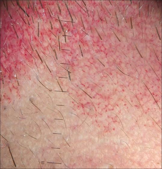 https://cdn.ncbi.nlm.nih.gov/pmc/blobs/e013/11152494/77fb43e71fd0/IDOJ-15-415-g003.jpg