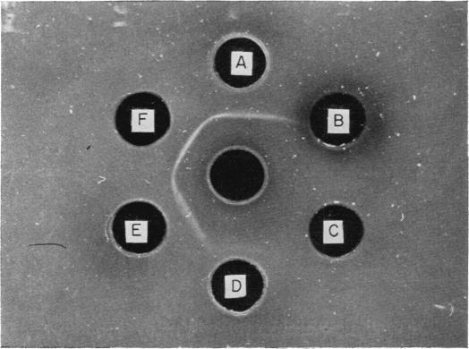 https://cdn.ncbi.nlm.nih.gov/pmc/blobs/e019/1455836/cb5efbeeabf2/immunology00362-0154-a.jpg