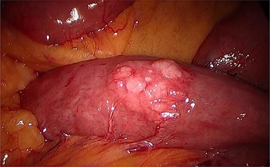 https://cdn.ncbi.nlm.nih.gov/pmc/blobs/e01a/11221315/20eab01618a3/rjae439f1.jpg