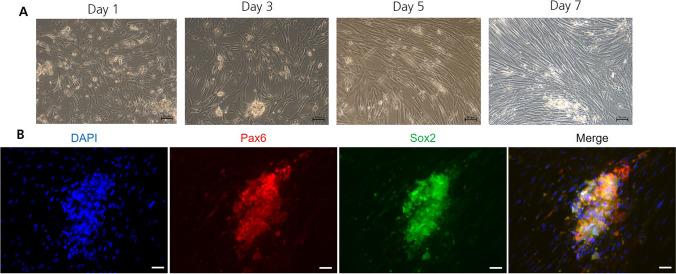 https://cdn.ncbi.nlm.nih.gov/pmc/blobs/e01b/10390376/35e1086e45d9/12015_2023_10538_Fig2_HTML.jpg