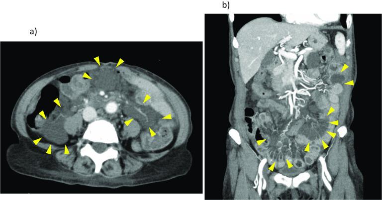 https://cdn.ncbi.nlm.nih.gov/pmc/blobs/e01b/8971343/a0024f6ac302/40792_2022_1411_Fig1_HTML.jpg