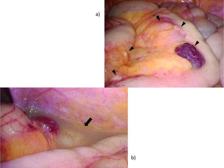 https://cdn.ncbi.nlm.nih.gov/pmc/blobs/e01b/8971343/ab2e508b0ec6/40792_2022_1411_Fig5_HTML.jpg