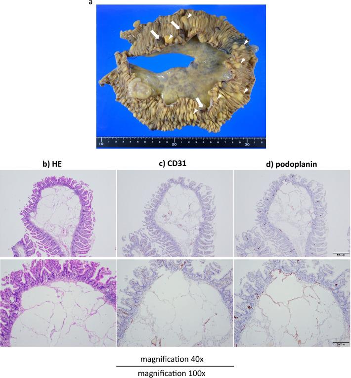 https://cdn.ncbi.nlm.nih.gov/pmc/blobs/e01b/8971343/b8998c11aed7/40792_2022_1411_Fig6_HTML.jpg