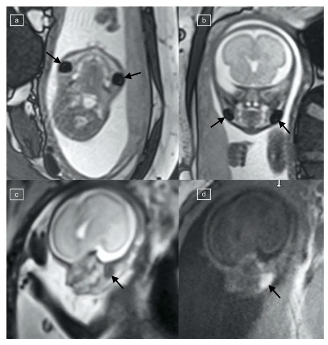 https://cdn.ncbi.nlm.nih.gov/pmc/blobs/e021/11048762/24b9b3809040/children-11-00463-g001.jpg