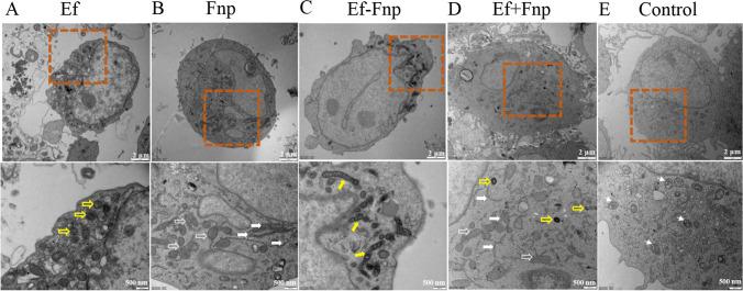 https://cdn.ncbi.nlm.nih.gov/pmc/blobs/e023/11102388/5cbf0ff1c91f/253_2024_13172_Fig5_HTML.jpg