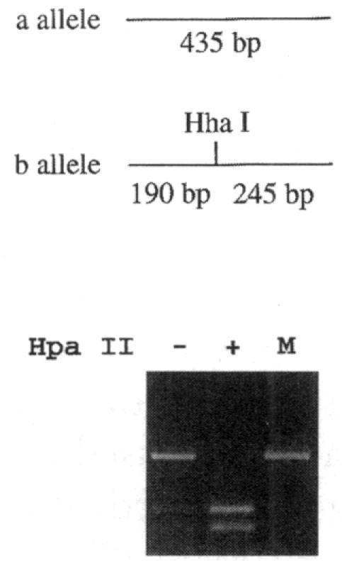 https://cdn.ncbi.nlm.nih.gov/pmc/blobs/e028/1715913/969008384829/ajhg00008-0056-c.jpg