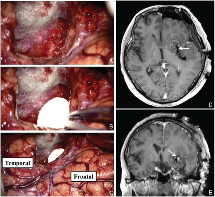 https://cdn.ncbi.nlm.nih.gov/pmc/blobs/e02b/5364932/0b40298c1a46/nmccrj-2-036-g002.jpg