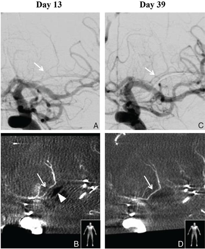 https://cdn.ncbi.nlm.nih.gov/pmc/blobs/e02b/5364932/e2cb08327465/nmccrj-2-036-g003.jpg