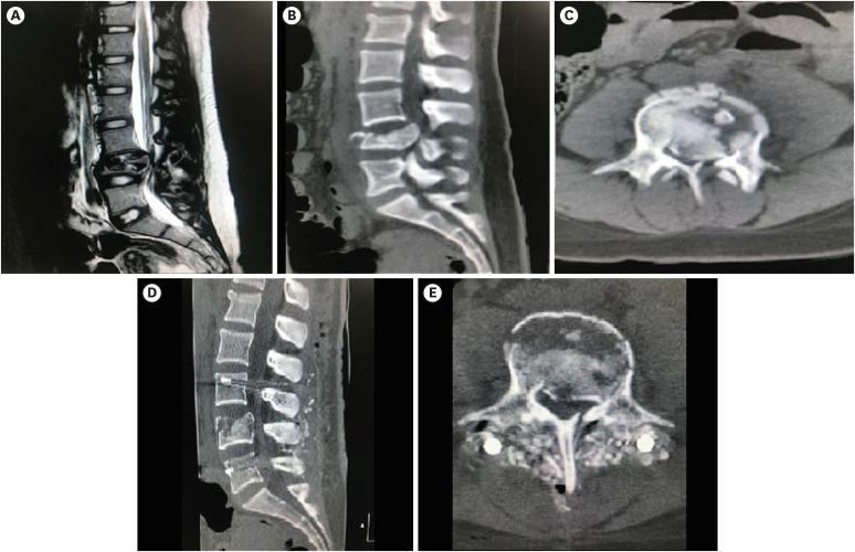 https://cdn.ncbi.nlm.nih.gov/pmc/blobs/e02f/10083448/779bb2c06f62/kjn-19-90-g002.jpg