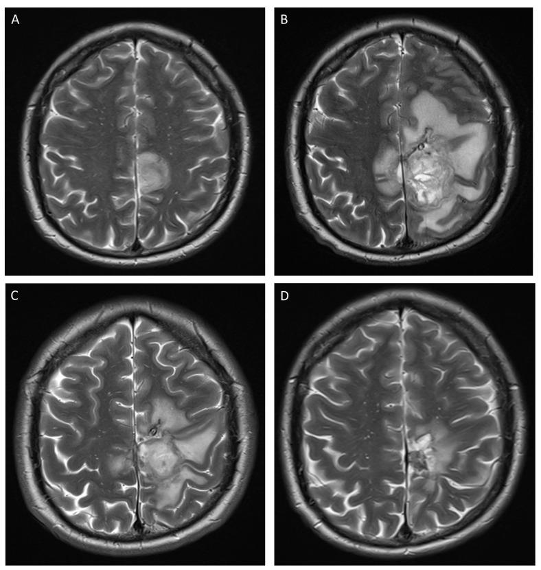 https://cdn.ncbi.nlm.nih.gov/pmc/blobs/e030/10054323/f4915d1ccb88/jof-09-00327-g001.jpg