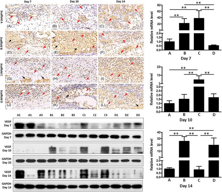https://cdn.ncbi.nlm.nih.gov/pmc/blobs/e032/10099260/bb3ca59b3727/JBM-111-763-g004.jpg