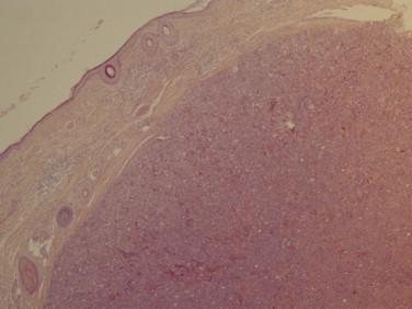 https://cdn.ncbi.nlm.nih.gov/pmc/blobs/e038/4353927/b299cbcbc446/gr1.jpg
